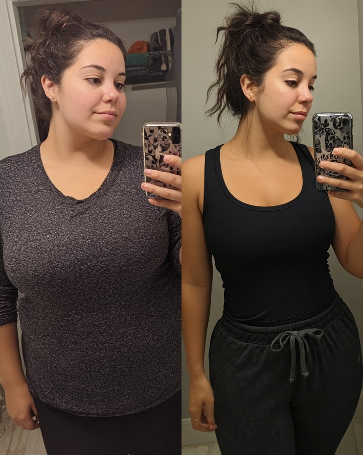 Before and after weight loss
