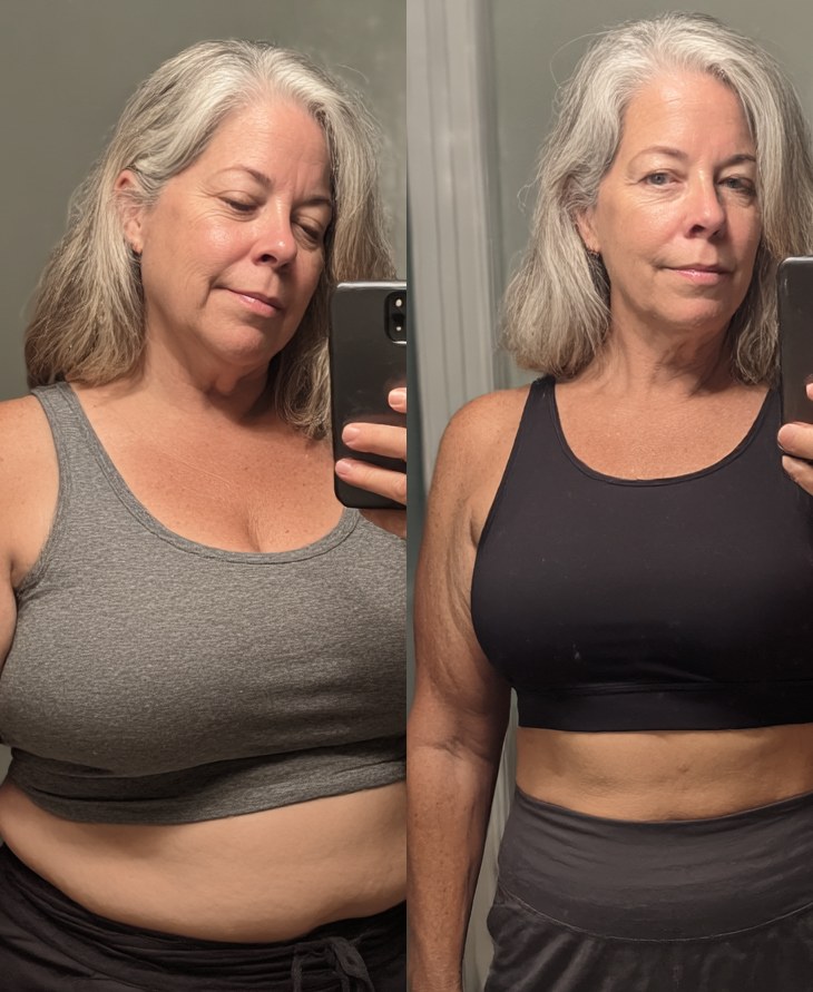 Before and after weight loss
